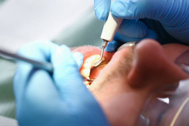 Best Emergency Root Canal Therapy in Oakton, VA